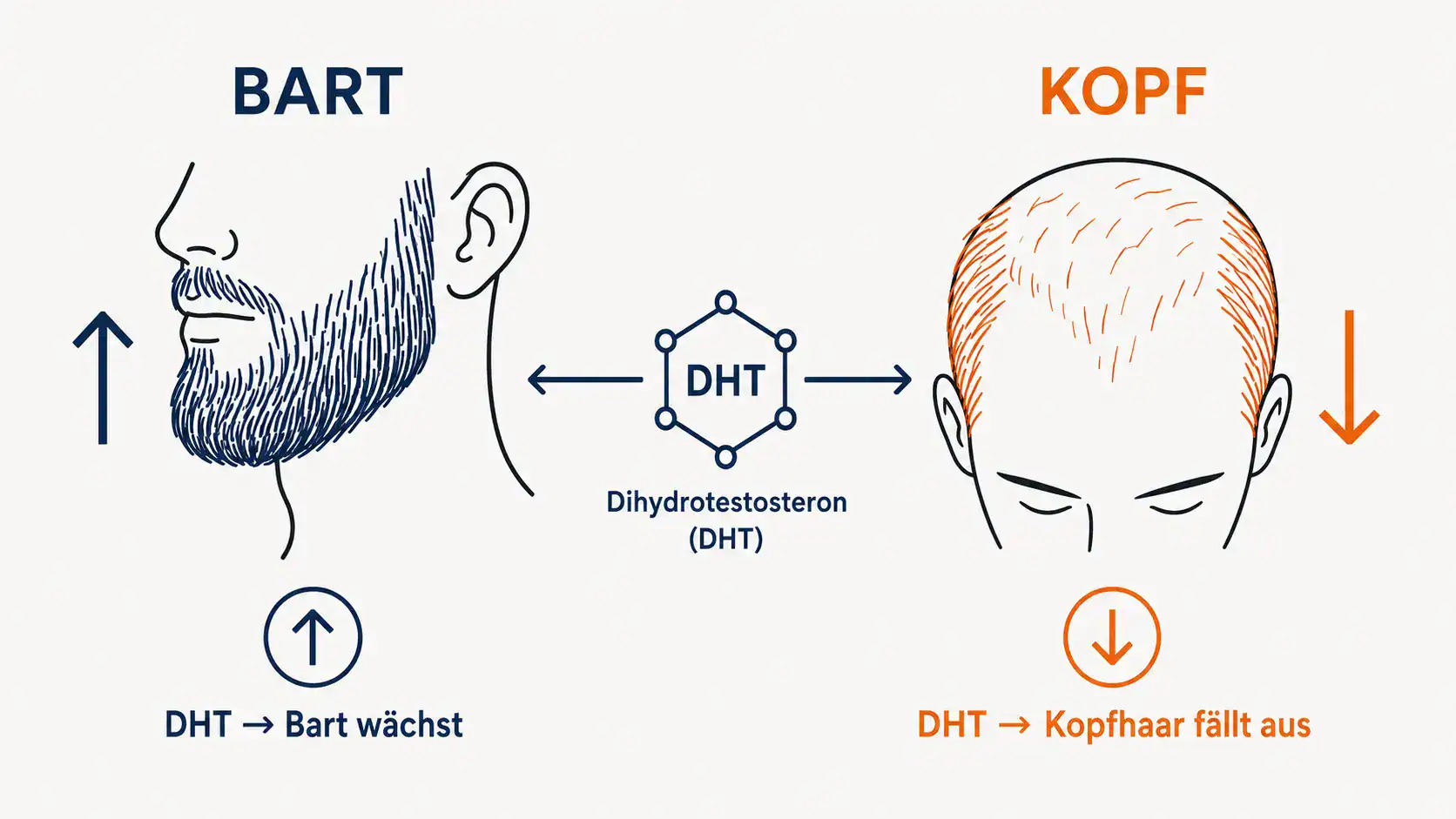 Infografik Androgen-Paradoxon: DHT lässt den Bart wachsen, aber das Kopfhaar ausfallen
